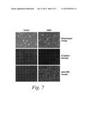 DIAGNOSTIC BIOMARKERS FOR FIBROTIC DISORDERS diagram and image