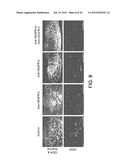 COMPOSITIONS AND METHODS COMPRISING VEGFR-2 AND VEGFR-3 ANTAGONISTS FOR     THE TREATMENT OF METASTATIC DISEASE diagram and image