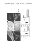 COMPOSITIONS AND METHODS COMPRISING VEGFR-2 AND VEGFR-3 ANTAGONISTS FOR     THE TREATMENT OF METASTATIC DISEASE diagram and image