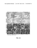 COMPOSITIONS AND METHODS COMPRISING VEGFR-2 AND VEGFR-3 ANTAGONISTS FOR     THE TREATMENT OF METASTATIC DISEASE diagram and image