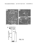 COMPOSITIONS AND METHODS COMPRISING VEGFR-2 AND VEGFR-3 ANTAGONISTS FOR     THE TREATMENT OF METASTATIC DISEASE diagram and image