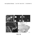 COMPOSITIONS AND METHODS COMPRISING VEGFR-2 AND VEGFR-3 ANTAGONISTS FOR     THE TREATMENT OF METASTATIC DISEASE diagram and image