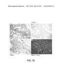 COMPOSITIONS AND METHODS COMPRISING VEGFR-2 AND VEGFR-3 ANTAGONISTS FOR     THE TREATMENT OF METASTATIC DISEASE diagram and image