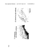SUPPRESSANT FOR ATHEROSCLEROSIS diagram and image