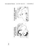 SUPPRESSANT FOR ATHEROSCLEROSIS diagram and image