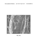 GEL BASED WOUND DRESSING AND A METHOD OF SYNTHESIZING THE SAME diagram and image