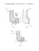 DENTAL TREATMENT APPARATUS AND METHOD diagram and image