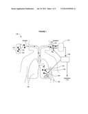 Method, device, or system using lung sensor for detecting a physiological     condition in a vertebrate subject diagram and image