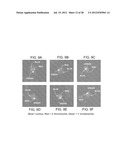 DETERMINATION OF FETAL ANEUPLOIDY BY QUANTIFICATION OF GENOMIC DNA FROM     MIXED SAMPLES diagram and image