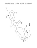 ELECTRICAL CONTACT FOR INTERCONNECT MEMBER diagram and image