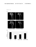 COMPOSITION FOR THE PREVENTION OR TREATMENT OF BONE DISEASES COMPRISING     COLFORSIN DAROPATE diagram and image