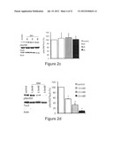 Treatment of Alzheimer s Disease diagram and image