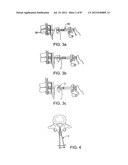 DEVICES AND METHODS FOR TISSUE MODIFICATION diagram and image