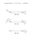 DEVICES AND METHODS FOR TISSUE MODIFICATION diagram and image