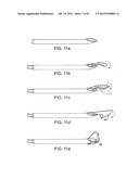 DEVICES AND METHODS FOR TISSUE MODIFICATION diagram and image