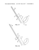 DEVICES AND METHODS FOR TISSUE MODIFICATION diagram and image