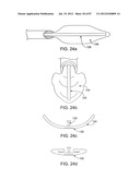 DEVICES AND METHODS FOR TISSUE MODIFICATION diagram and image