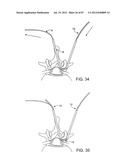 DEVICES AND METHODS FOR TISSUE MODIFICATION diagram and image