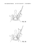 DEVICES AND METHODS FOR TISSUE MODIFICATION diagram and image