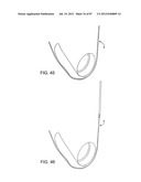 DEVICES AND METHODS FOR TISSUE MODIFICATION diagram and image