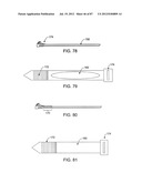 DEVICES AND METHODS FOR TISSUE MODIFICATION diagram and image