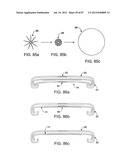 DEVICES AND METHODS FOR TISSUE MODIFICATION diagram and image