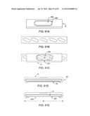 DEVICES AND METHODS FOR TISSUE MODIFICATION diagram and image