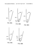 DEVICES AND METHODS FOR TISSUE MODIFICATION diagram and image