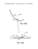 DEVICES AND METHODS FOR TISSUE MODIFICATION diagram and image