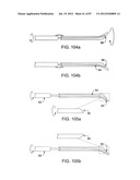 DEVICES AND METHODS FOR TISSUE MODIFICATION diagram and image