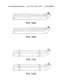 DEVICES AND METHODS FOR TISSUE MODIFICATION diagram and image