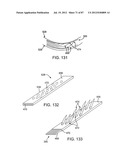 DEVICES AND METHODS FOR TISSUE MODIFICATION diagram and image