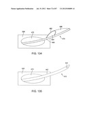 DEVICES AND METHODS FOR TISSUE MODIFICATION diagram and image