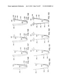 DEVICES AND METHODS FOR TISSUE MODIFICATION diagram and image