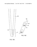 DEVICES AND METHODS FOR TISSUE MODIFICATION diagram and image