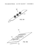 DEVICES AND METHODS FOR TISSUE MODIFICATION diagram and image