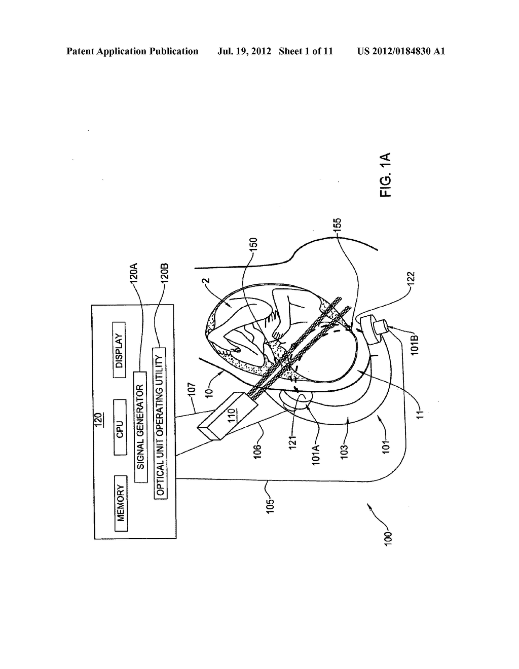 METHOD AND APPARATUS FOR NONINVASIVELY MONITORING PARAMETERS OF A REGION     OF INTEREST IN A HUMAN BODY - diagram, schematic, and image 02
