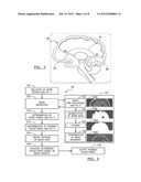 Method for Planning a Surgical Procedure diagram and image