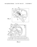 Method for Planning a Surgical Procedure diagram and image