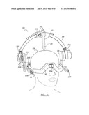 Method for Planning a Surgical Procedure diagram and image