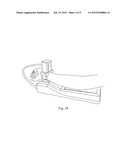 Pulse Diagnosis Instrument diagram and image