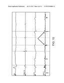 ELECTROANATOMICAL MAPPING diagram and image