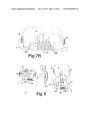 Inserter Device with Horizontal Moving Part diagram and image