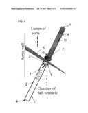  MULTICOMPONENT MAGNETIC NANOPARTICLE DELIVERY SYSTEM FOR LOCAL DELIVERY     TO HEART VALVE LEAFLETS AND OTHER ANIMAL TISSUES diagram and image