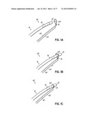 SYSTEMS, DEVICES AND METHODS FOR TREATING THE HEART WITH ABLATION diagram and image