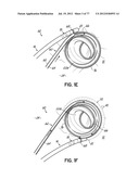 SYSTEMS, DEVICES AND METHODS FOR TREATING THE HEART WITH ABLATION diagram and image