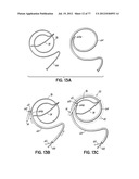 SYSTEMS, DEVICES AND METHODS FOR TREATING THE HEART WITH ABLATION diagram and image