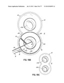 SYSTEMS, DEVICES AND METHODS FOR TREATING THE HEART WITH ABLATION diagram and image