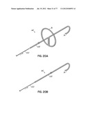 SYSTEMS, DEVICES AND METHODS FOR TREATING THE HEART WITH ABLATION diagram and image