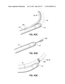 SYSTEMS, DEVICES AND METHODS FOR TREATING THE HEART WITH ABLATION diagram and image